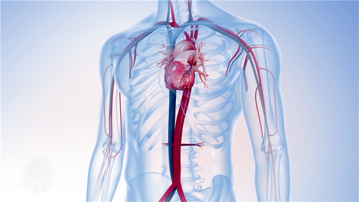 心脏手术-三维动画演示过程