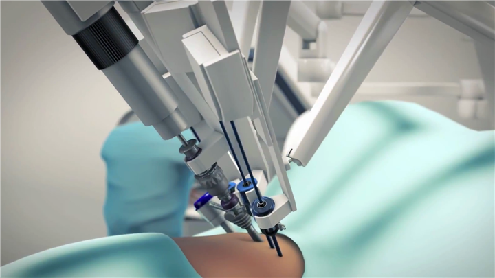 前列腺切除手术-3D动画演示